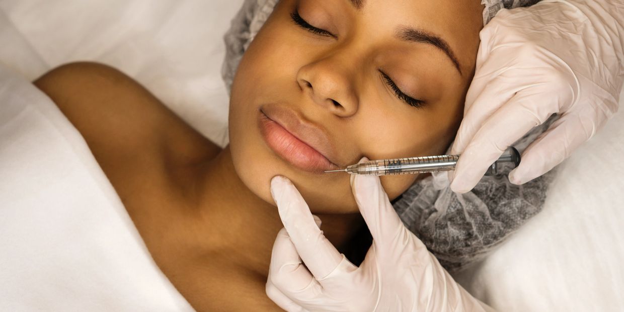 Smoker or Lipstick Lines Treatment
