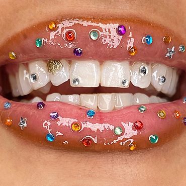 Beauty shot of tooth jewelry. Teeth whitening also offered both mobile and in Highland Park, Los Ang