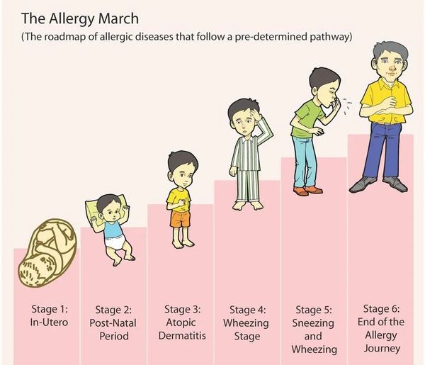 ALLERGY MARCH