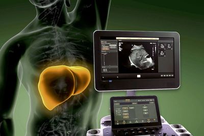 Elastografia
Ultrassom