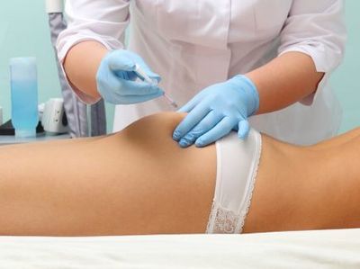 Intadermoterapia
Celulite
Estrias
Gordura Localizada
Flacidez