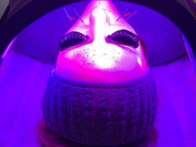 Facial acupuncture treatment with LED light therapy
