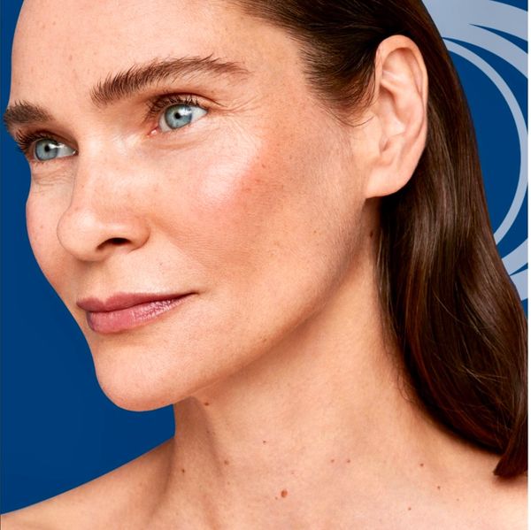 Radiesse treatment in hazel grove . Promotes collagen stimulation and skin rejuvenation in multiple areas of the face