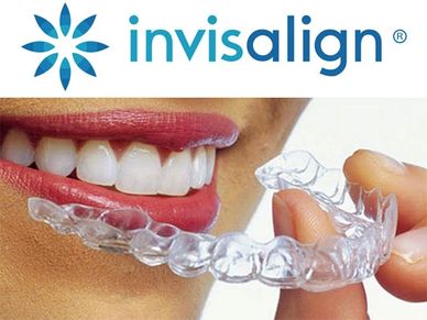Person holding a clear Invisalign aligner near their smile.