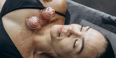 Cupping Therapy