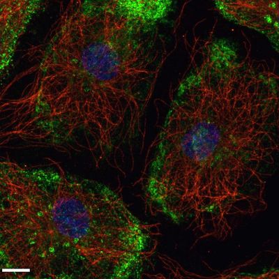  Immunofluorescence of primary human coronary artery endothelial cells for caveolin-1 (green) and be