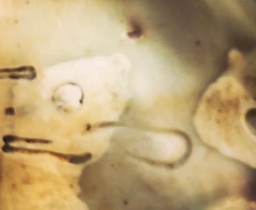 Microscopic close-up of tiny aquatic organisms with translucent bodies.