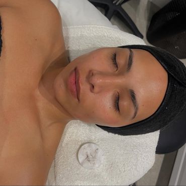 Dermaplane Service in Sebastian, FL