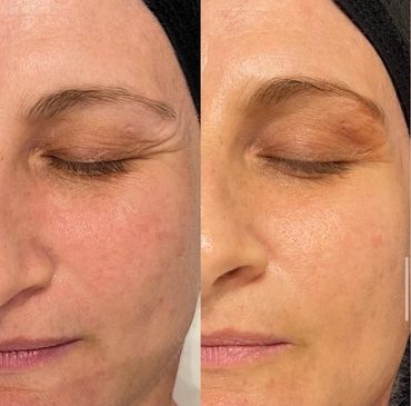 Facial Service in Sebastian, FL