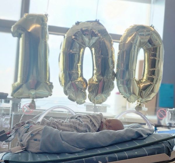 100 days of life is such a milestone for a micropreemie - it was such an emotional and rewarding day
