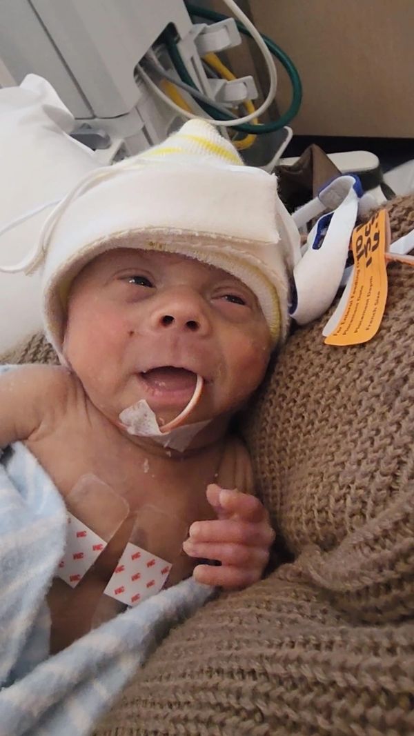 Liam's first time on a "room air trial"