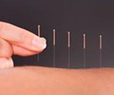 acupuncture for pain,migraines/headaches, fertility, osteoarthritis, hayfever, tendonitis, muscle 