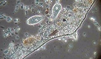 Microscopic view of microbes.