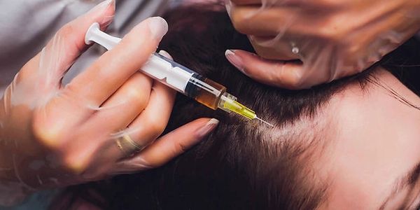 PRP injections in kingston ontario