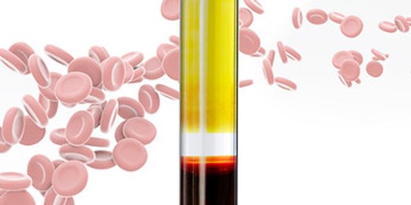 PRP in kingston ontario