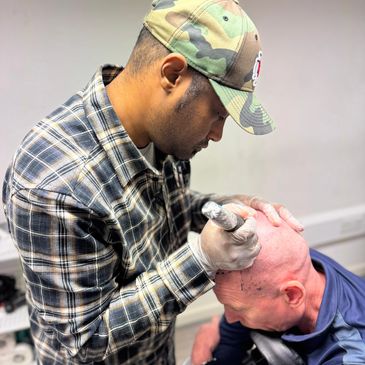 Scalp Micropigmentation Portsmouth
