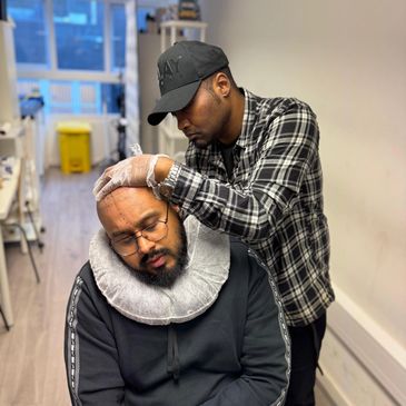 Scalp Micropigmentation