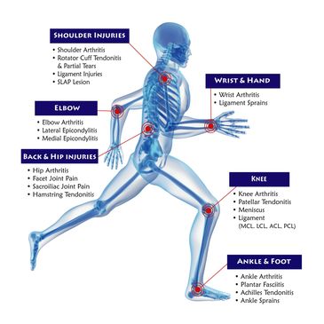 PRP
clinic
orthopedic
doctor
best
Platelet Rich Plasma
arthritis
joint
pain
knee
prayagraj
allahabad