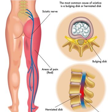 PRP
clinic
orthopedic
doctor
best
Platelet Rich Plasma
arthritis
joint
pain
knee
prayagraj
allahabad