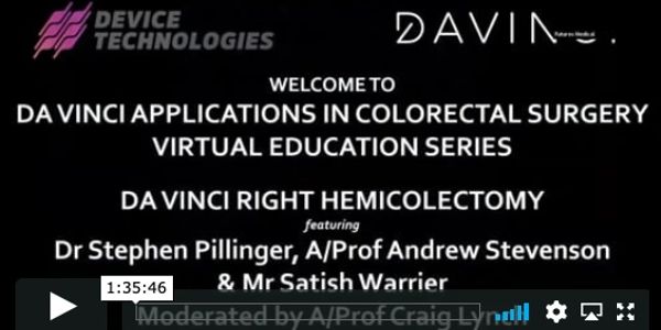 DaVinci applications in Colorectal surgery
DaVinci Right Hemicolectomy
Steve Pillinger Andrew Steven