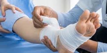 Medical professional wrapping an ankle with a bandage.