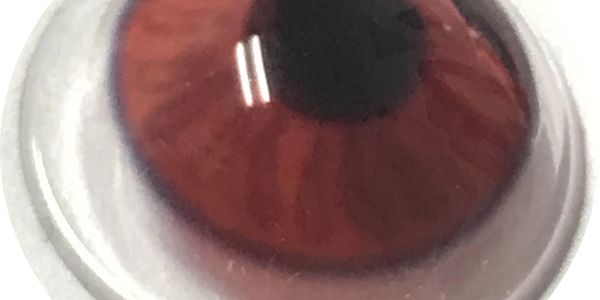 Iris tinted RGP Scleral Lens