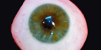 Thin Scleral Shell Cover