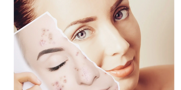 Clear & Brilliant Hydration Peel