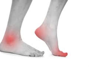 Foot and Ankle Pain. Plantar Fasciitis. specialist Osteopathy Clinic. Exercise and advice specialist