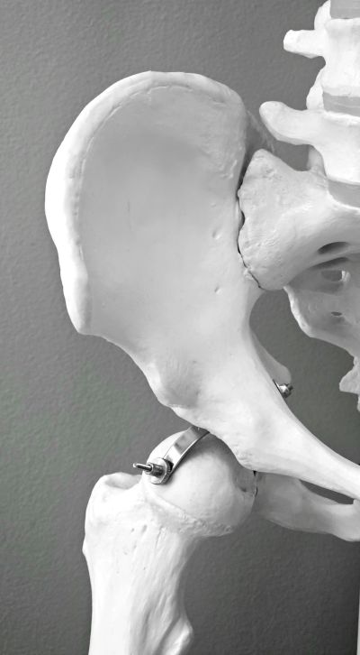 Close-up of a white anatomical hip bone model against a gray background.
