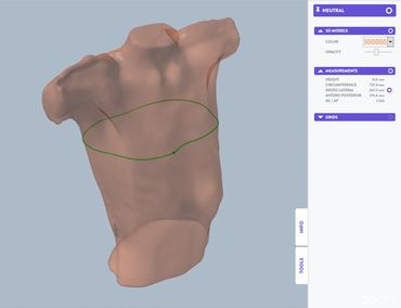 Pectus Excavatum Scanning Assessment