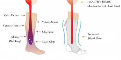 Coldwater Pharmacy has compression stockings that can be fitted while you wait for your prescription