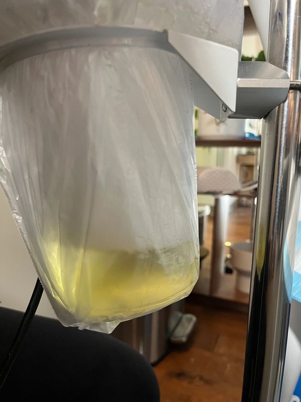 Extracorporeal Blood Oxygenation and Ozonation (EBOO) Therapy Lake Oswego at Evergreen Factor 97035.