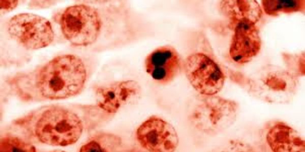 Extracorporeal Blood Oxygenation and Ozonation (EBOO) Therapy Lake Oswego at Evergreen Factor 97035.