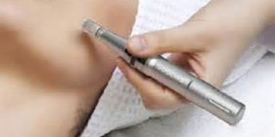 Dermal Needling.