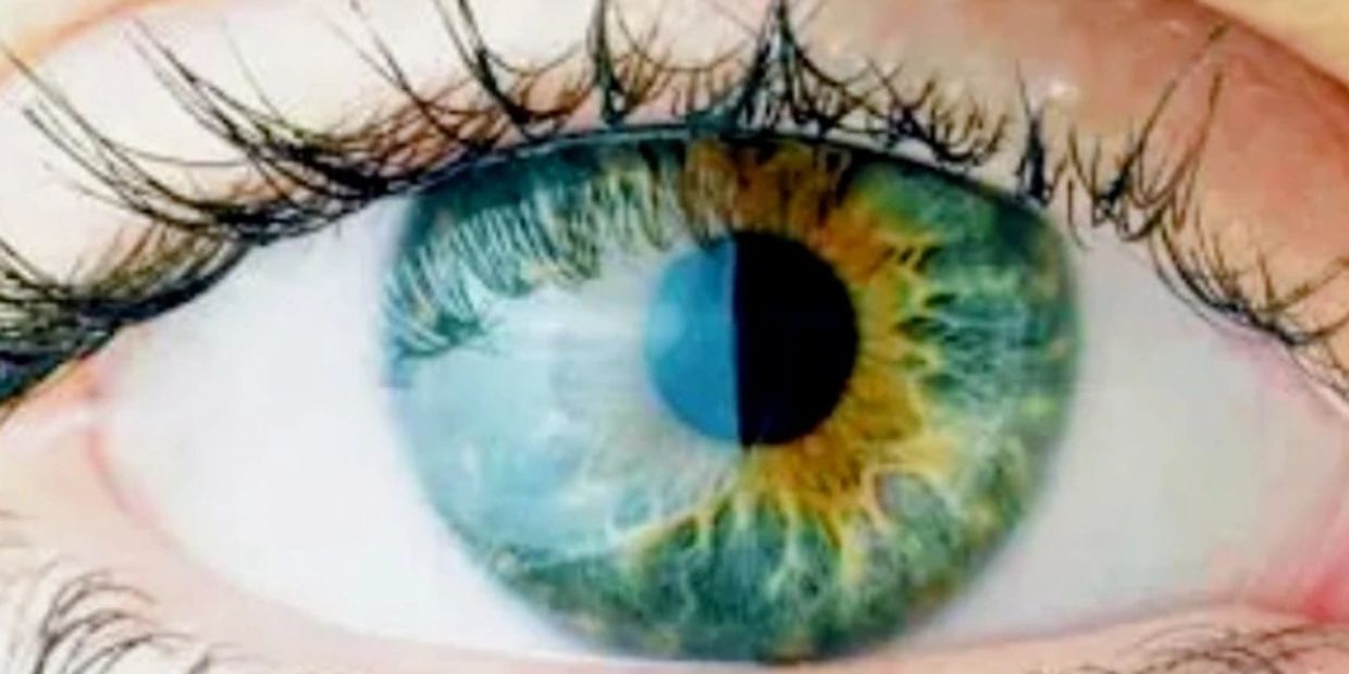 Iridology therapy reads the iris as a sacred map of your internal organs. It's also the science that