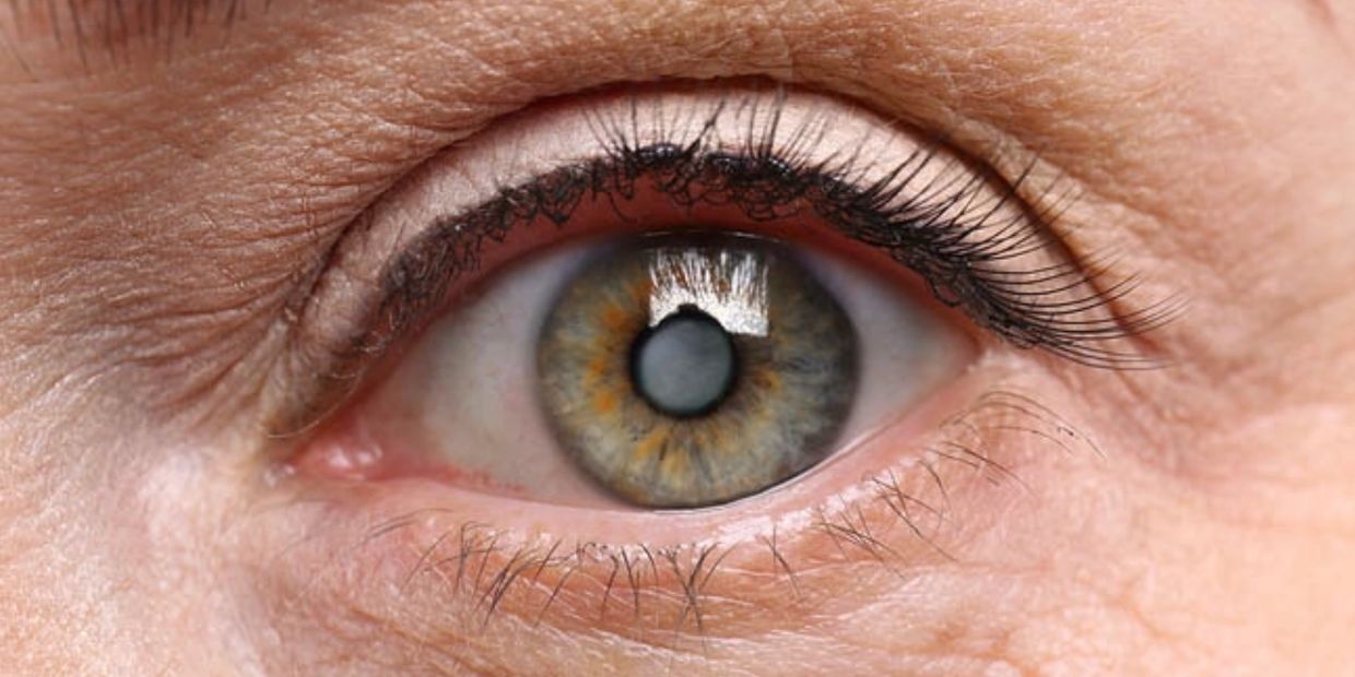 Professor Ian Pearce
Ophthalmologist Liverpool
Cataract
AMD
Macular Hole
Retinal Expert