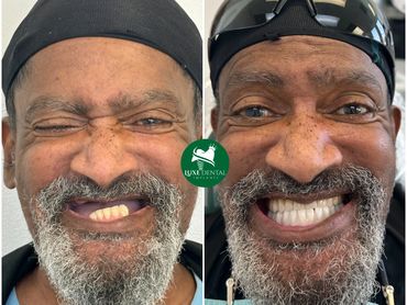 Before After Smile make over