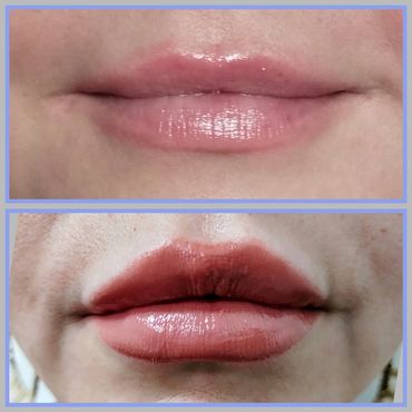 Lip Filler Columbus GA