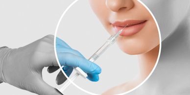 Procedimiento estético con una jeringa aplicando una sustancia en los labios de una persona.