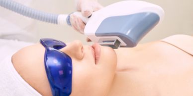 Tratamiento facial con un dispositivo láser, paciente con gafas protectoras.