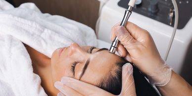 Una mujer recibiendo un tratamiento estético facial, utilizando un dispositivo de microdermoabrasión.