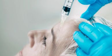 Mano enguantada en azul aplicando una inyección en el cuero cabelludo de una mujer recostada.