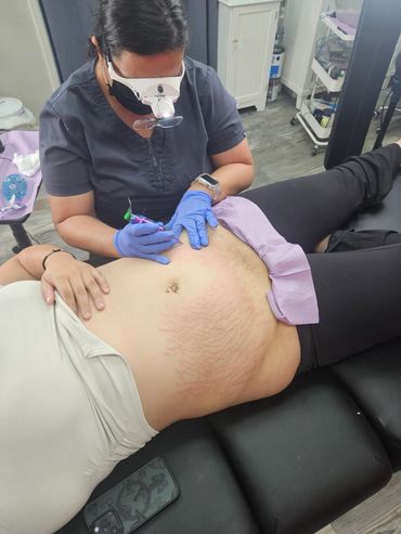 Paramedical Tattoo Training