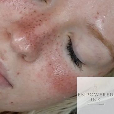 Faux Freckle Tattoo: Faux freckle tattoos are a fun and trendy way to add a playful touch to your lo