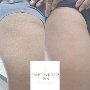 Stretch Mark Camouflage Training