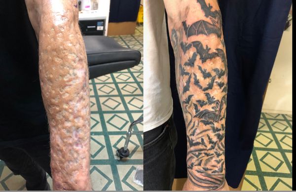Black and grey bat tattoos over scarring.