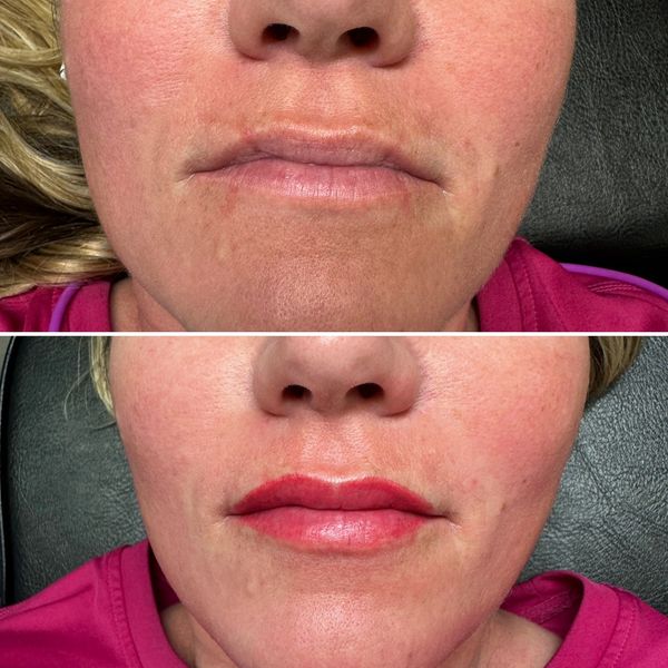 Lip Blush Before and After