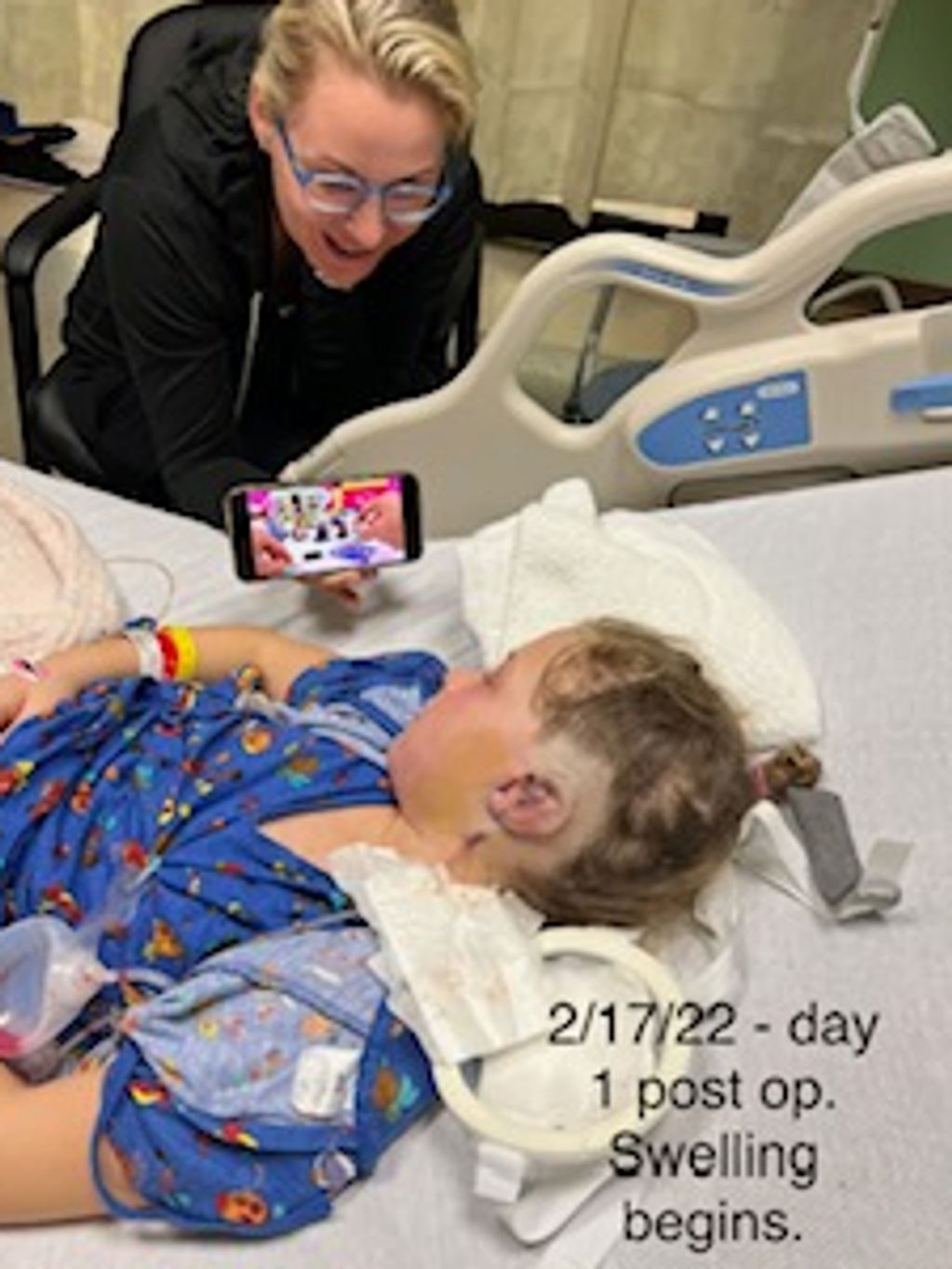 1 Day Post Op - Auntie Nicole Arrives