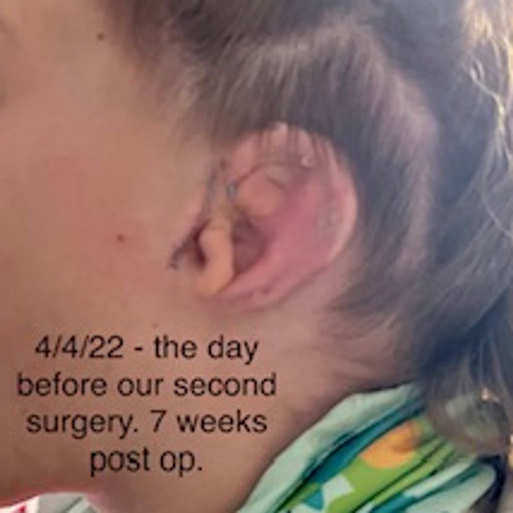 4/4/22 - Landed in Texas, Night Before Surgery 2